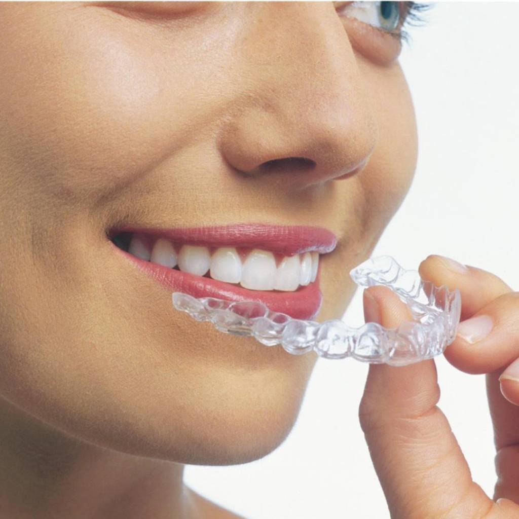 Invisalign - Ortodoncia invisible